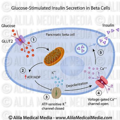 Healthy Natural Therapy | Beta cell dysfunction and insulin resistance